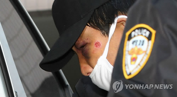 组图：被韩逮捕的中国船长眼部有大块淤青