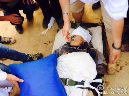 云南鲁甸震区88岁老人被埋近50小时后获救
