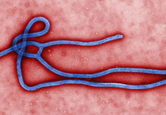 埃博拉